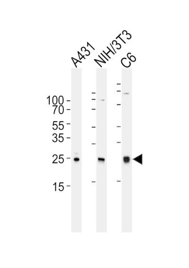 RAC1 Antibody in Western Blot (WB)