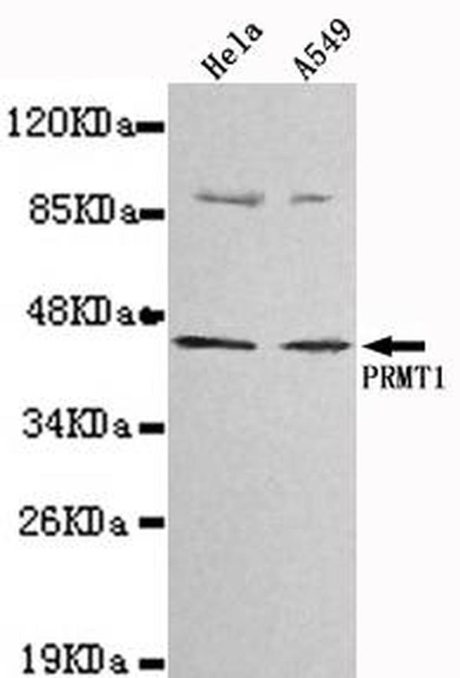 PRMT1 Antibody in Western Blot (WB)