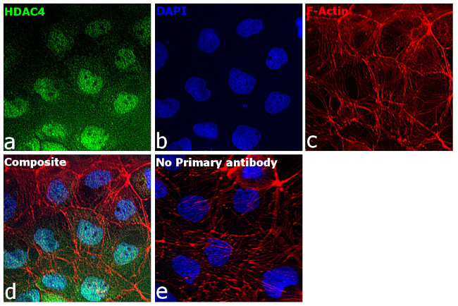 HDAC4 Antibody in Immunocytochemistry (ICC/IF)