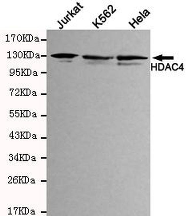 HDAC4 Antibody in Western Blot (WB)