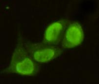 PRMT6 Antibody in Immunocytochemistry (ICC/IF)