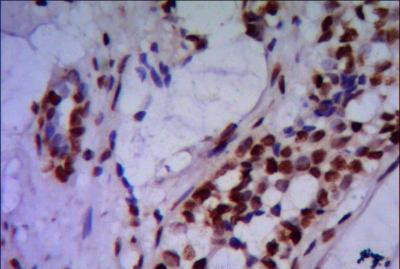 PRMT6 Antibody in Immunohistochemistry (Paraffin) (IHC (P))