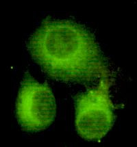 ATP Citrate Lyase Antibody in Immunocytochemistry (ICC/IF)