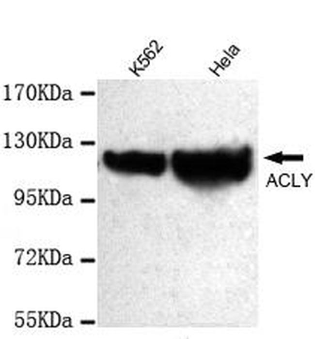 ATP Citrate Lyase Antibody in Western Blot (WB)