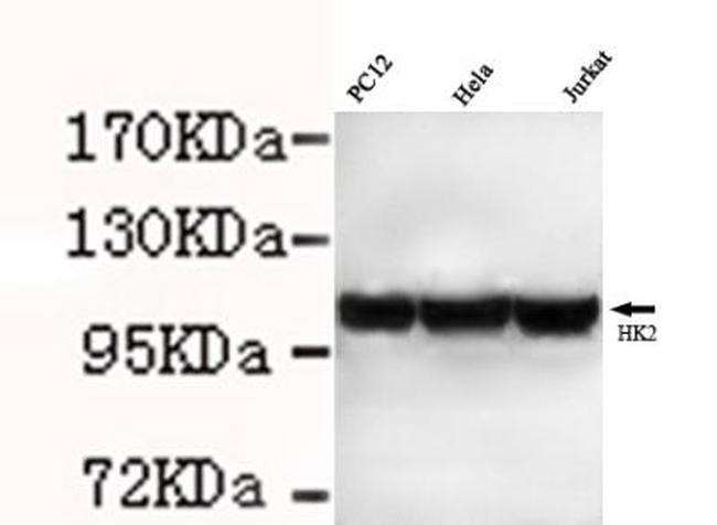 HK2 Antibody in Western Blot (WB)