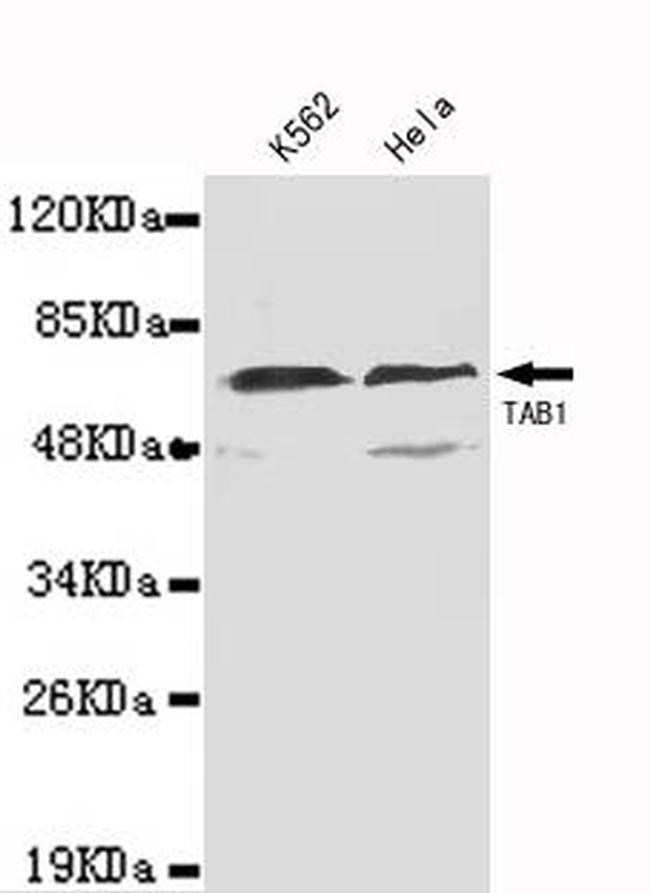 TAB1 Antibody in Western Blot (WB)