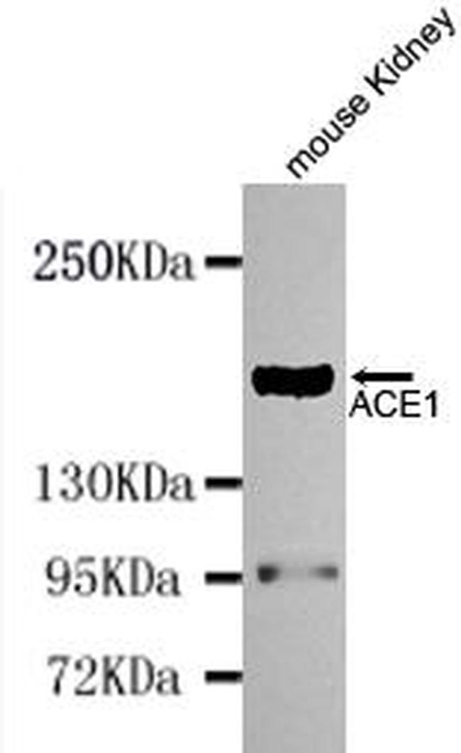 ACE Antibody in Western Blot (WB)