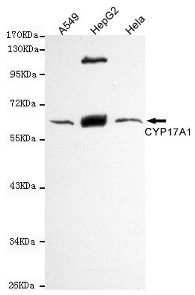 CYP17A1 Antibody in Western Blot (WB)