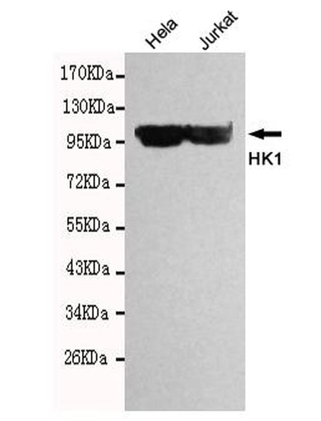 HK1 Antibody in Western Blot (WB)