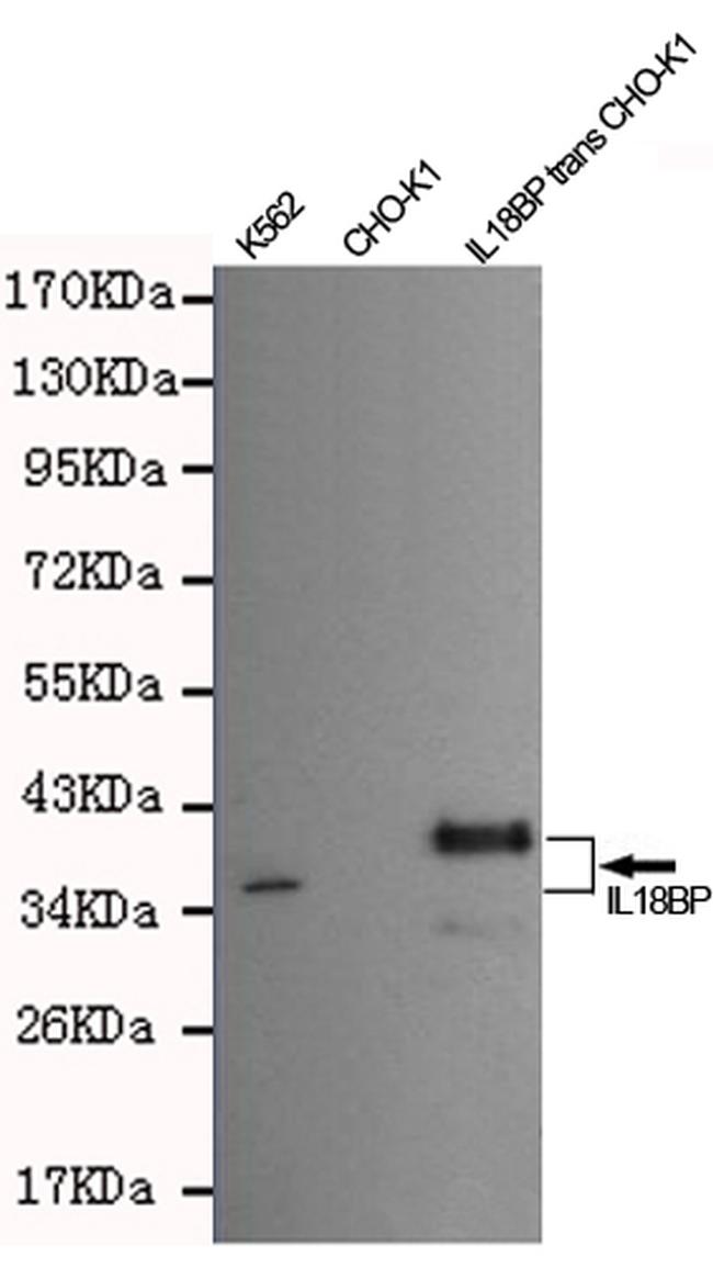 IL18BP Antibody in Western Blot (WB)