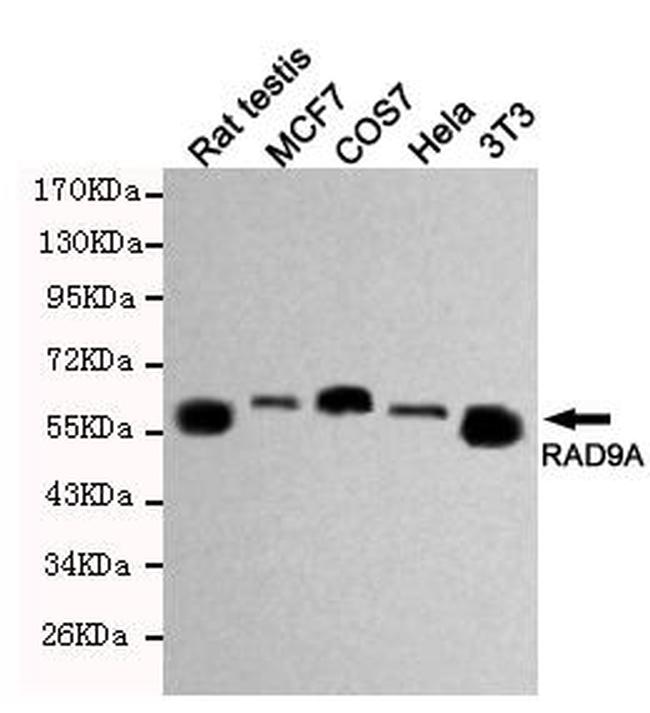 RAD9 Antibody in Western Blot (WB)