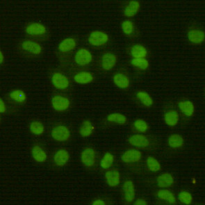 FEN1 Antibody in Immunocytochemistry (ICC/IF)