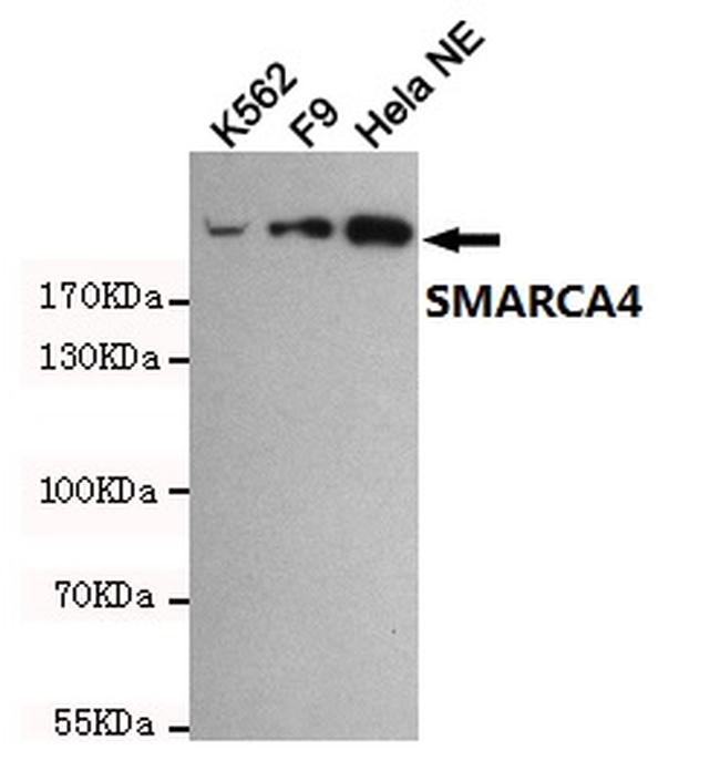 BRG1 Antibody in Western Blot (WB)