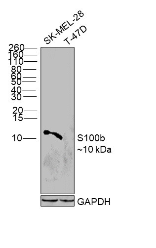 S100B Antibody in Western Blot (WB)