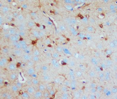 S100B Antibody in Immunohistochemistry (Paraffin) (IHC (P))