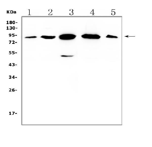 Gelsolin Antibody in Western Blot (WB)