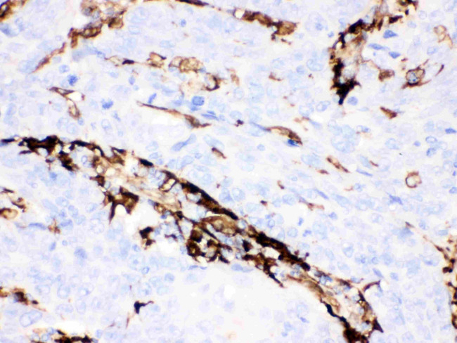 Gelsolin Antibody in Immunohistochemistry (Paraffin) (IHC (P))