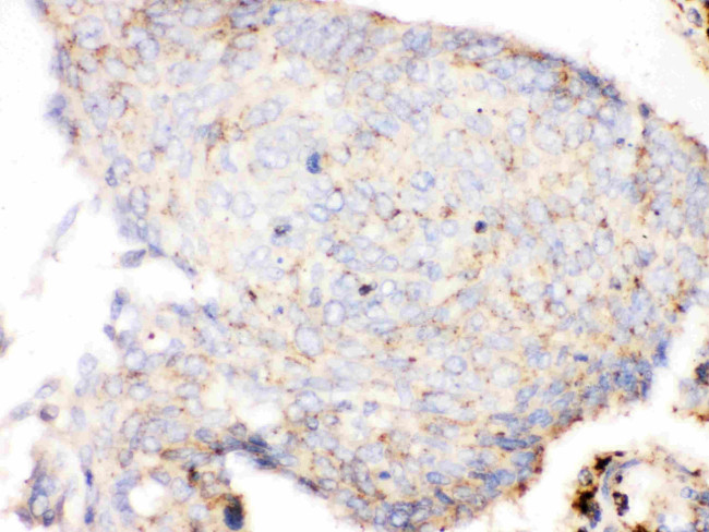 Cathepsin D Antibody in Immunohistochemistry (Paraffin) (IHC (P))