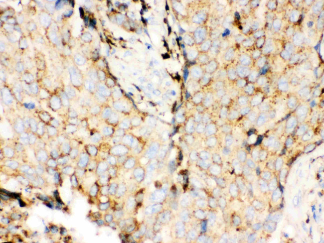 Cathepsin D Antibody in Immunohistochemistry (Paraffin) (IHC (P))