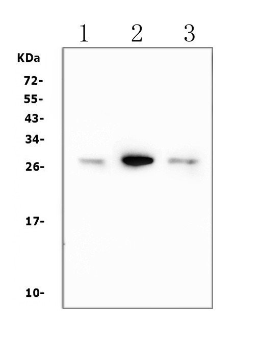 Calbindin D28K Antibody in Western Blot (WB)