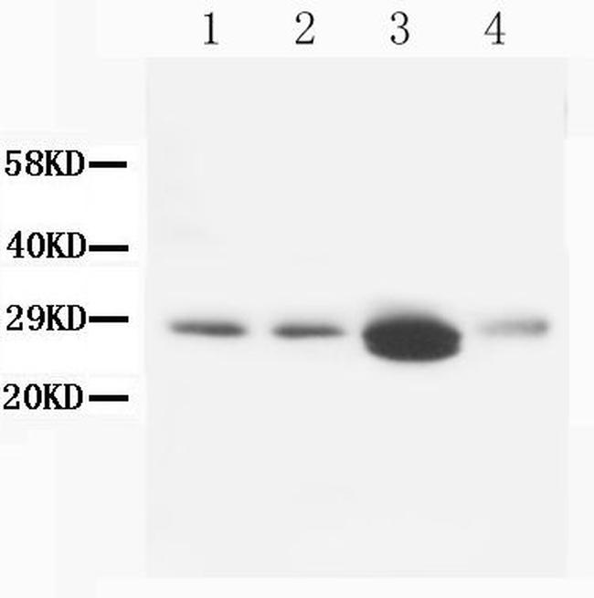 Calbindin D28K Antibody in Western Blot (WB)