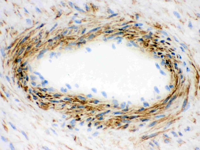 Actin Antibody in Immunohistochemistry (Frozen) (IHC (F))