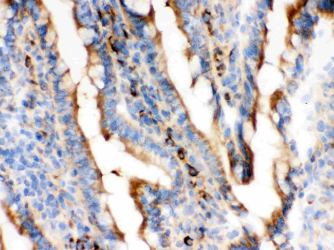 Actin Antibody in Immunohistochemistry (Frozen) (IHC (F))