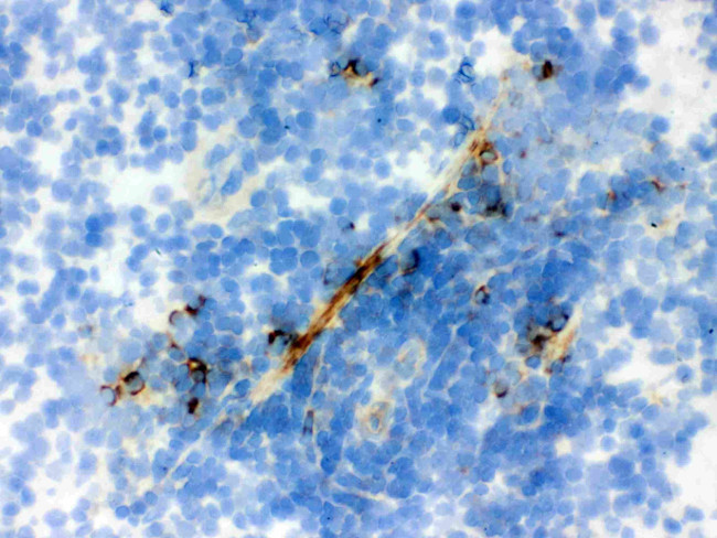 Actin Antibody in Immunohistochemistry (Frozen) (IHC (F))