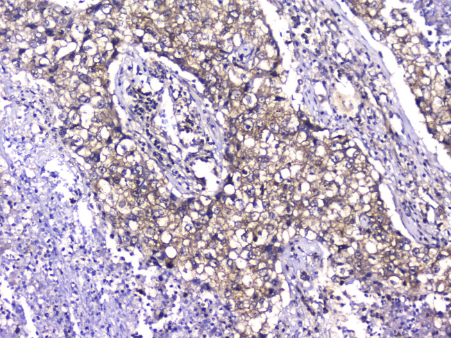 TCP1 Antibody in Immunohistochemistry (Paraffin) (IHC (P))