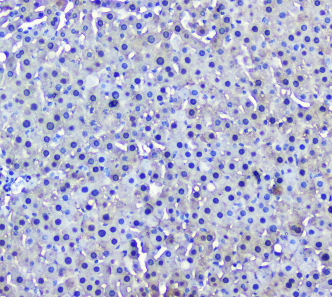 GSTM1 Antibody in Immunohistochemistry (Paraffin) (IHC (P))