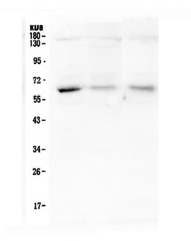 Arylsulfatase A Antibody in Western Blot (WB)