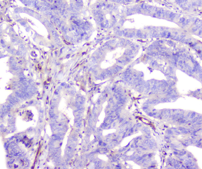 Adenosine Deaminase Antibody in Immunohistochemistry (Paraffin) (IHC (P))