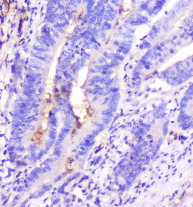 Adenosine Deaminase Antibody in Immunohistochemistry (Paraffin) (IHC (P))