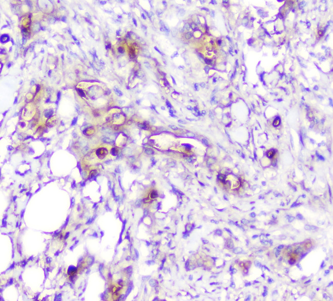 Adenosine Deaminase Antibody in Immunohistochemistry (Paraffin) (IHC (P))