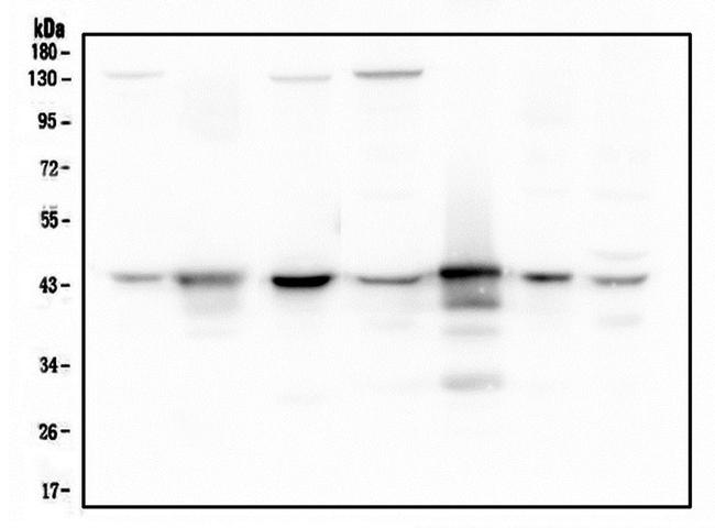 Adenosine Deaminase Antibody in Western Blot (WB)