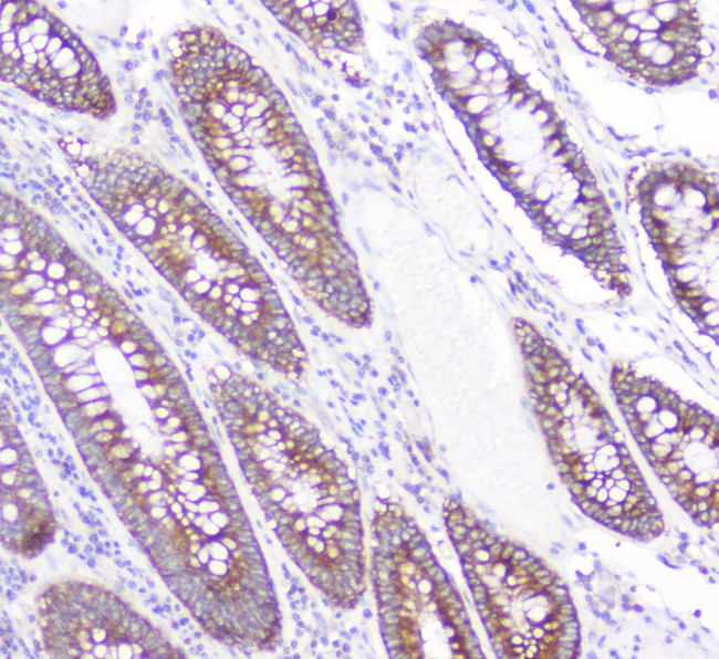 CD2AP Antibody in Immunohistochemistry (Paraffin) (IHC (P))