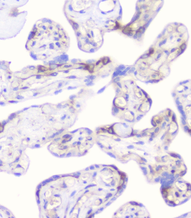 CD2AP Antibody in Immunohistochemistry (Paraffin) (IHC (P))