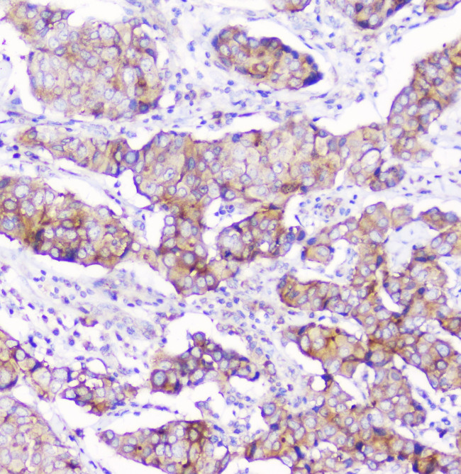 CD2AP Antibody in Immunohistochemistry (Paraffin) (IHC (P))