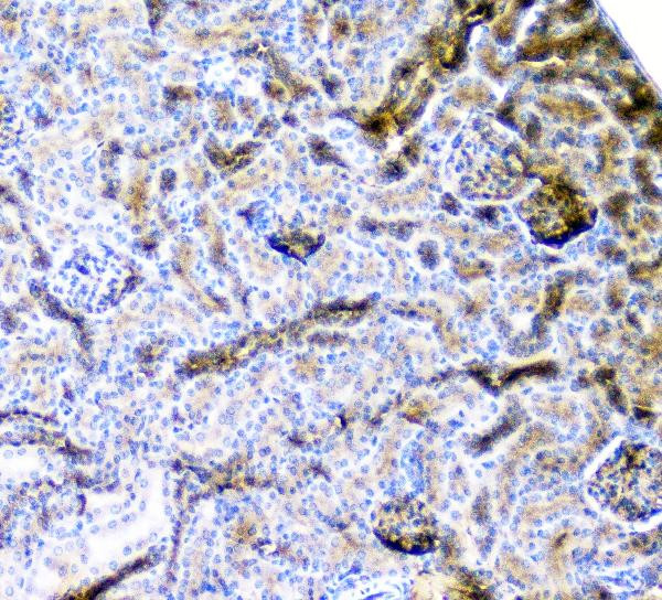 CD2AP Antibody in Immunohistochemistry (Paraffin) (IHC (P))