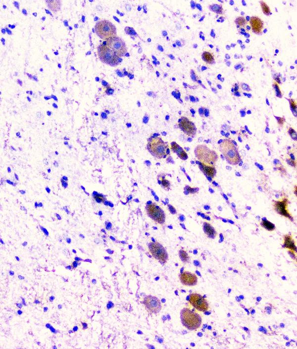 CD2AP Antibody in Immunohistochemistry (Paraffin) (IHC (P))