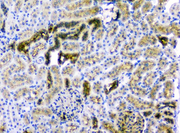 CD2AP Antibody in Immunohistochemistry (Paraffin) (IHC (P))