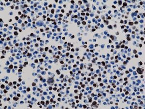 6x-His Tag Antibody in Immunocytochemistry (ICC/IF)