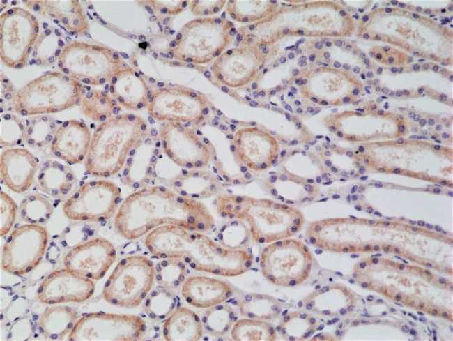 delta Catenin Antibody in Immunohistochemistry (Paraffin) (IHC (P))