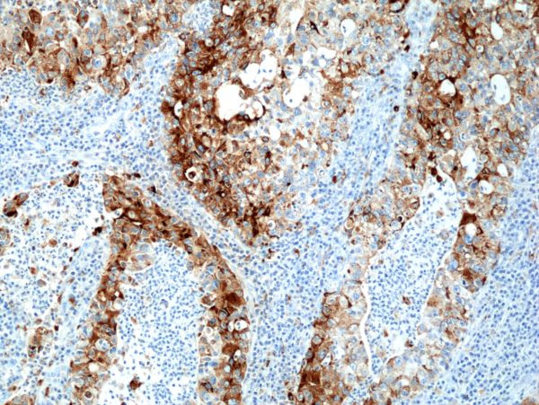 NAPSA Antibody in Immunohistochemistry (Paraffin) (IHC (P))