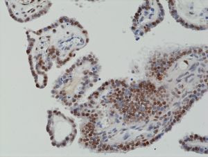 c-Fos Antibody in Immunohistochemistry (Paraffin) (IHC (P))