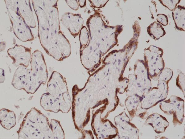 hCG Antibody in Immunohistochemistry (Paraffin) (IHC (P))