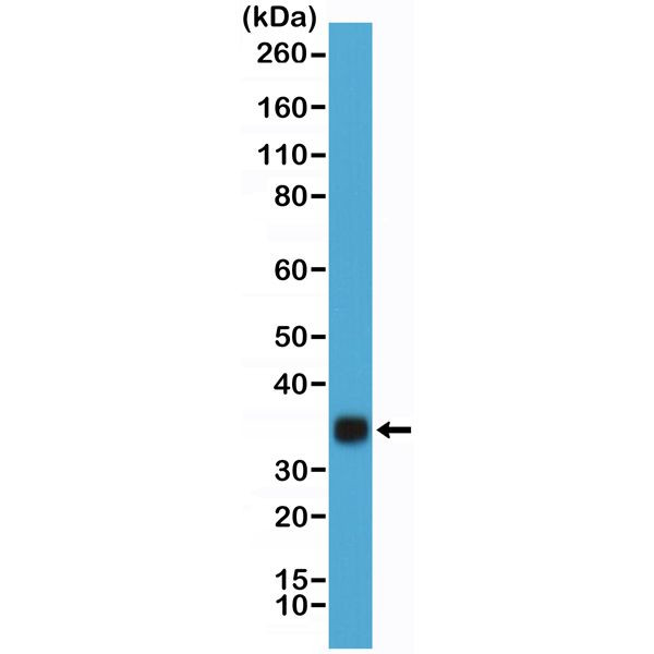 hCG Antibody in Western Blot (WB)