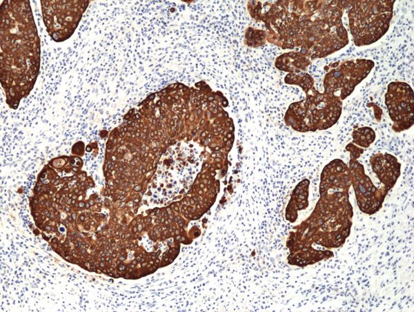 Cytokeratin 14 Antibody in Immunohistochemistry (Paraffin) (IHC (P))