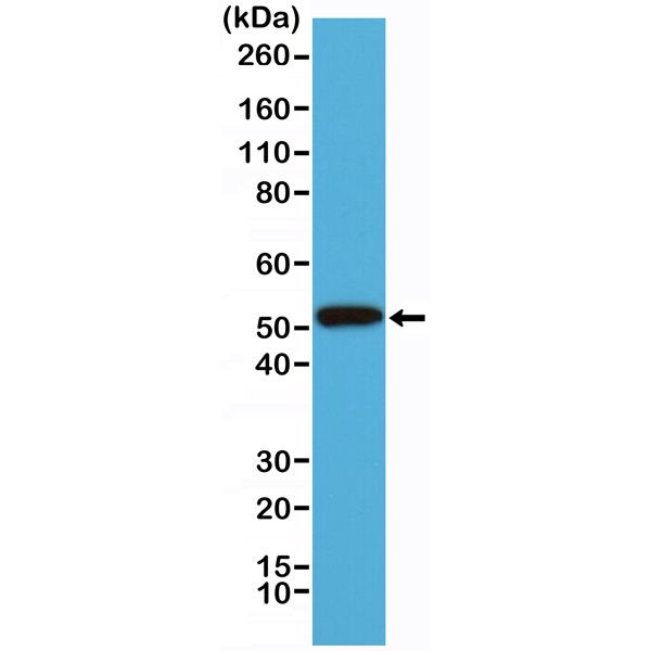 Cytokeratin 14 Antibody in Western Blot (WB)