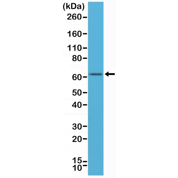 Estrogen Receptor alpha Antibody in Western Blot (WB)